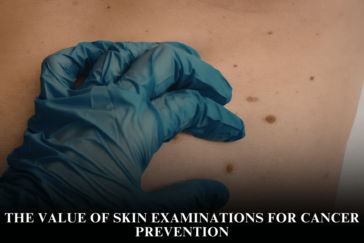 The Value of Skin Examinations for Cancer Prevention